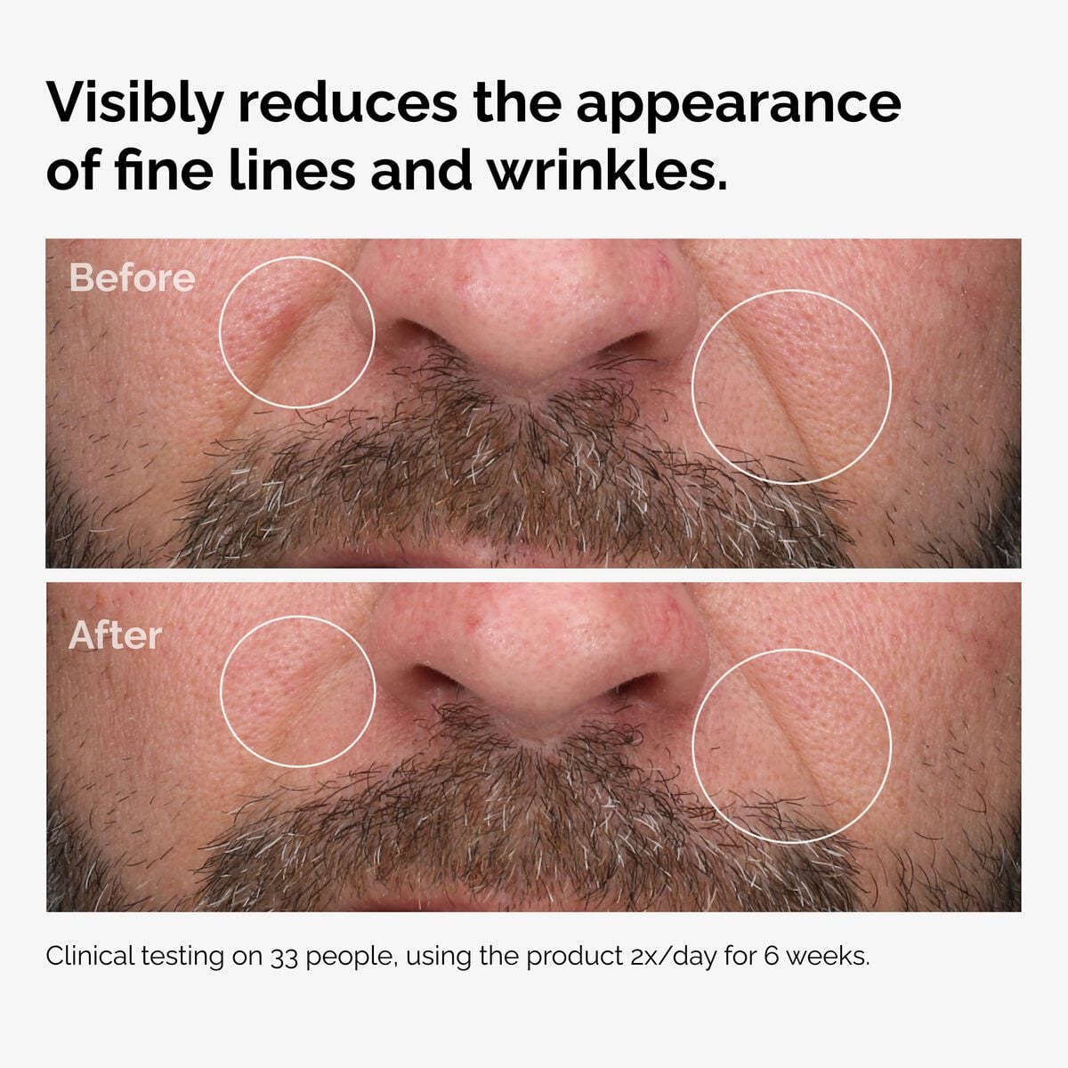 100-fermented-rose-hip-seed-oil-v3 100pct-fermented-rose-hip-before-after-wrinkles.jpg