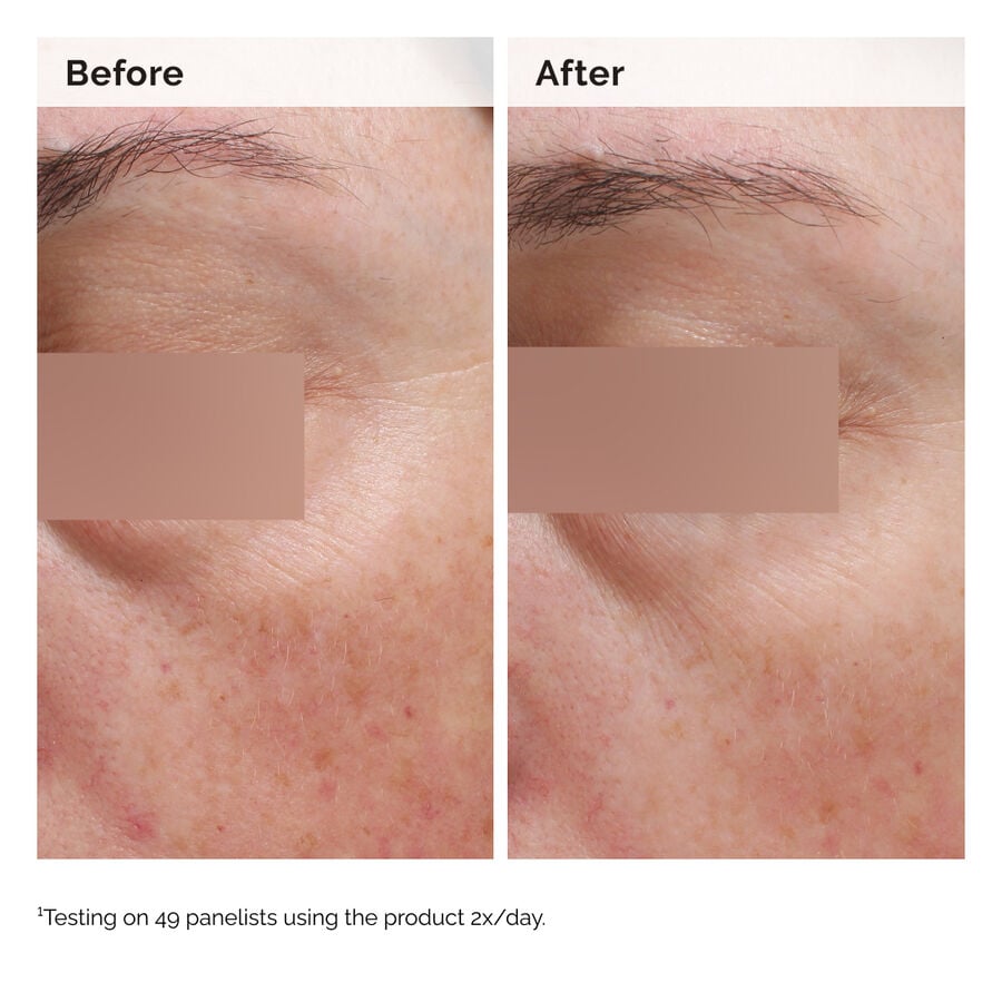 niacinamide-5-face-and-body-emulsion-j0 2024-08-23-ORD-Nia-5pct-Face-Body-B-A-Elasticity-Global-02-1x1.jpg