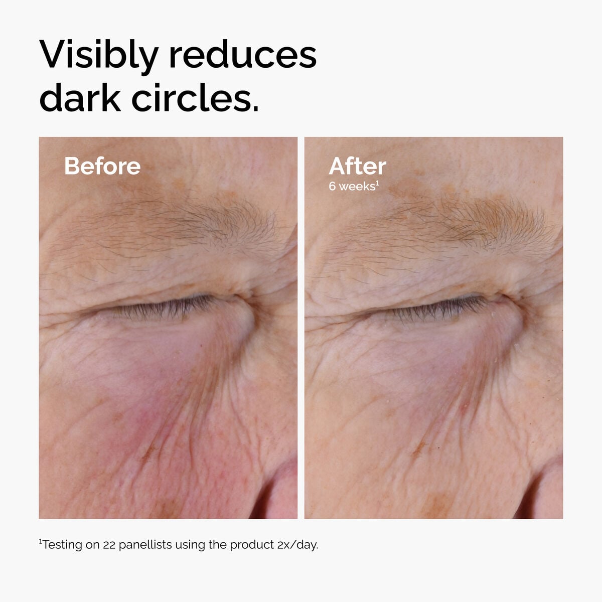 caffeine-solution-5-egcg-eye-serum-q0 ord-caffeine-solution-egcg-dark-circles-before-after.jpg