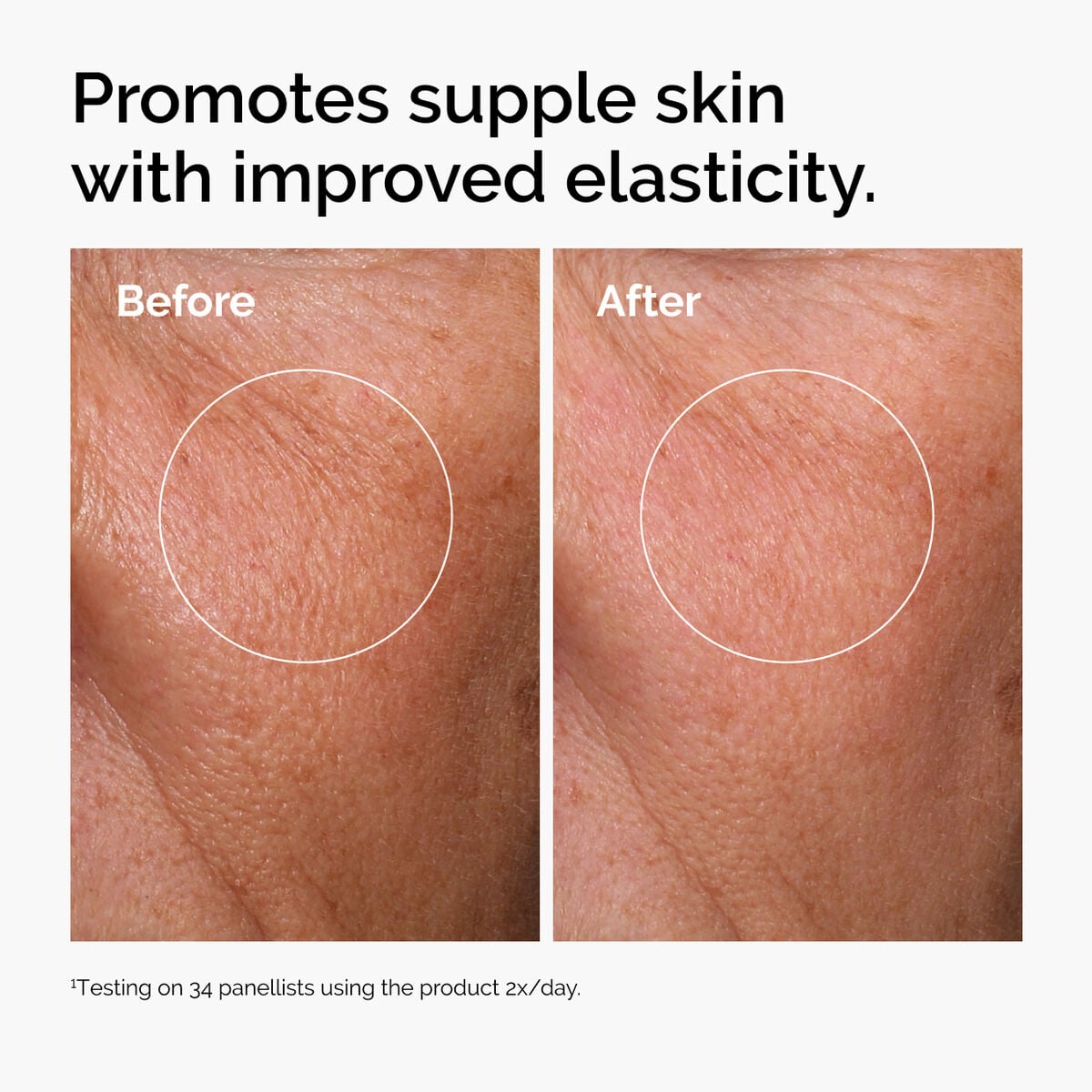 hyaluronic-acid-2-b5-with-ceramides-w0 ord-hyaluronic-acid-2pct-b5-hydrating-serum-before-after-elasticity.jpg