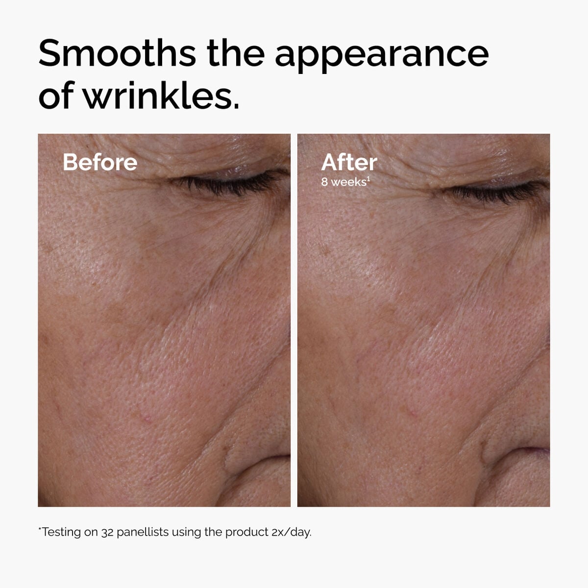 multi-peptide-ha-serum-b4 ord-multi-peptide-ha-serum-wrinkles-before-after.jpg