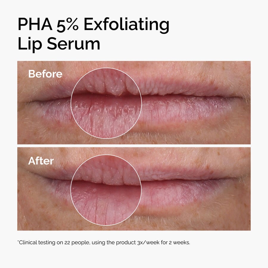 pha-5-exfoliating-lip-serum-g7 ord-pha-5pct-lip-exfoliating-serum-before-after.jpg