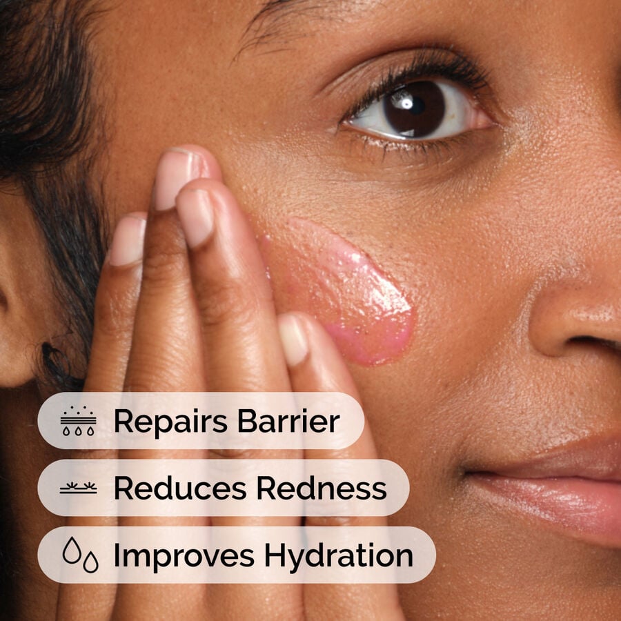 soothing-and-barrier-support-serum-n1 ord-soothing-barrier-support-serum-model-application-with-benefits.jpg