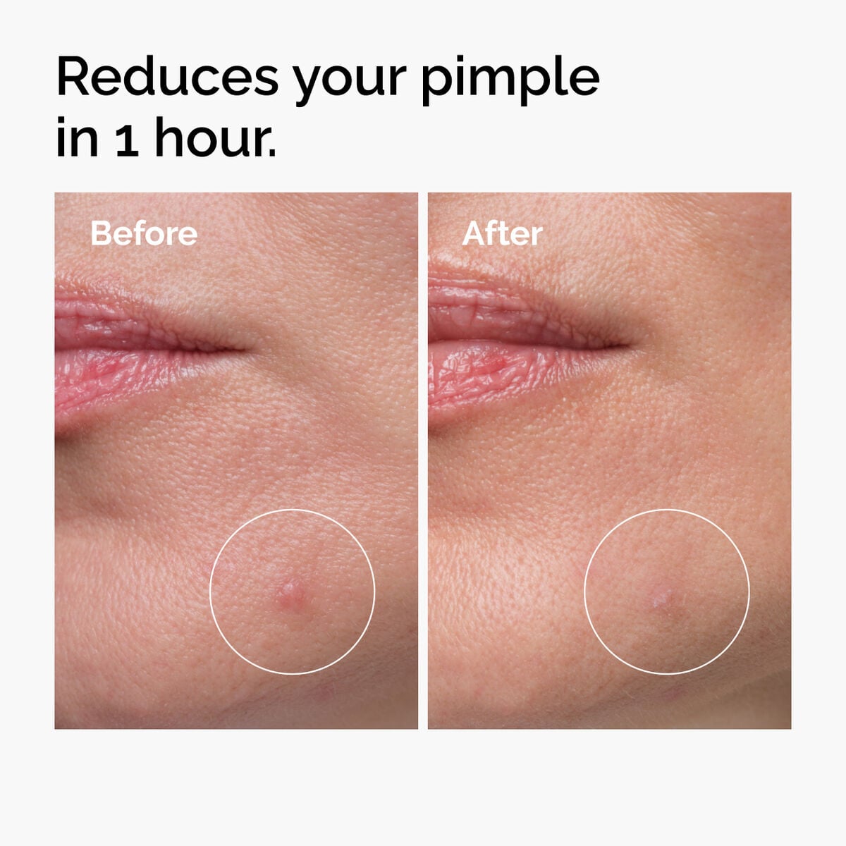 sulfur-10-powder-to-cream-concentrate-p5 ord-sulfur-10pct-powder-to-cream-concentrate-before-after-NA.jpg